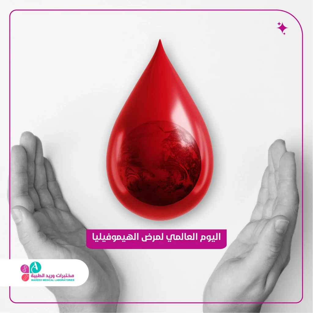 اليوم العالمي لمرض الهيموفيليا لاب