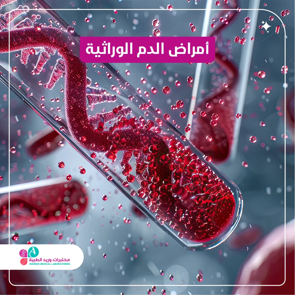 أمراض الدم الوراثية
