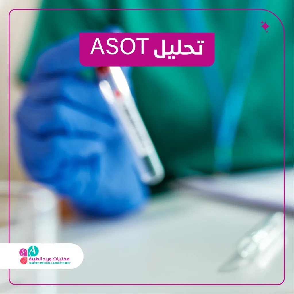 تحليل ASOT