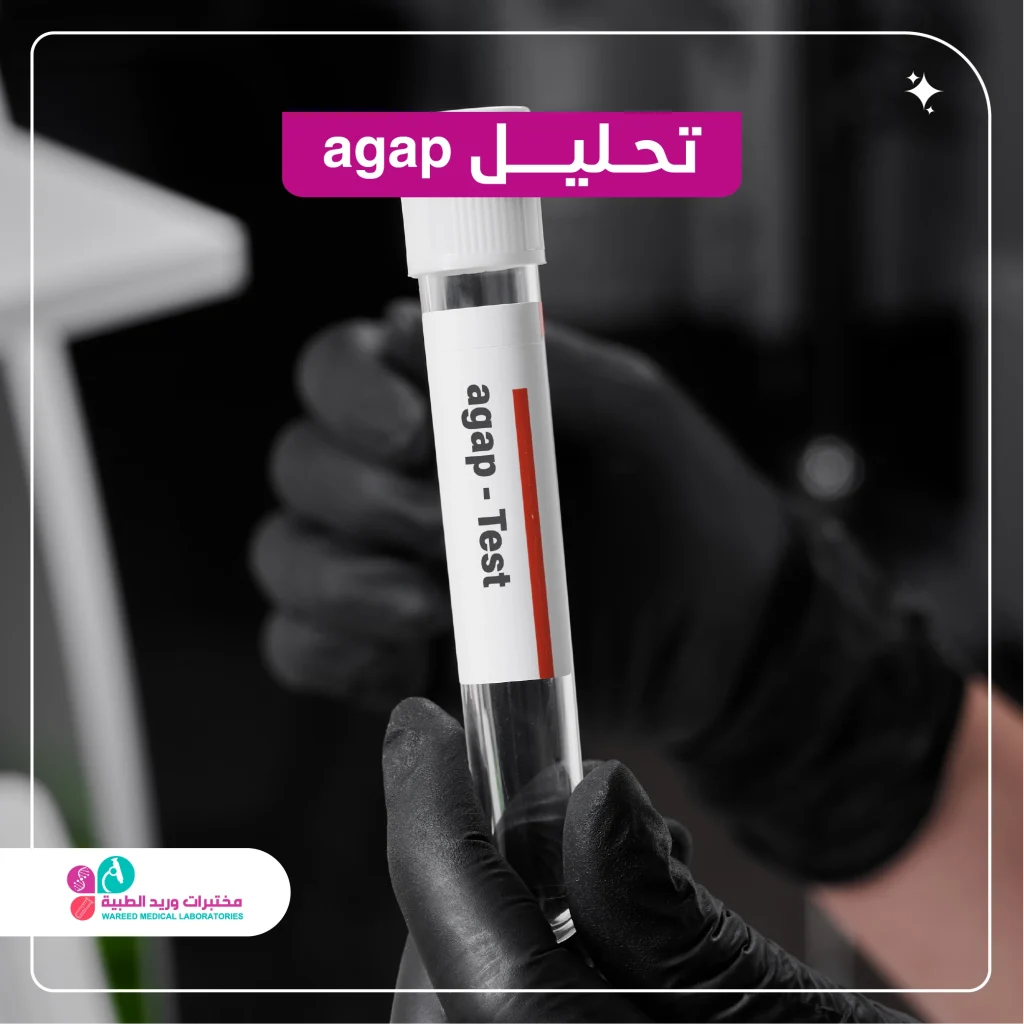 تحليل AGAP: دليل شامل لفهم الفحص، أهميته، ودوره في التشخيص الطبي