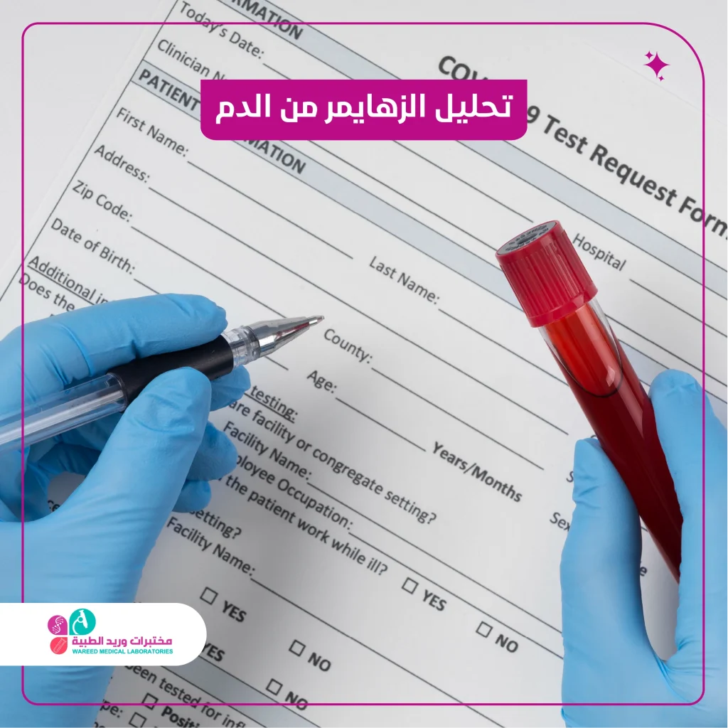 تحليل الزهايمر من الدم: ثورة تشخيصية مبكرة تعيد رسم مستقبل الرعاية الصحية