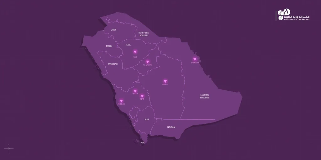 الخريطة