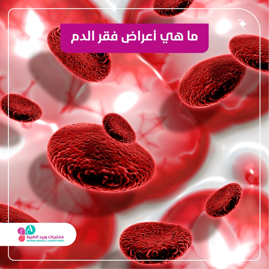 أعراض فقر الدم