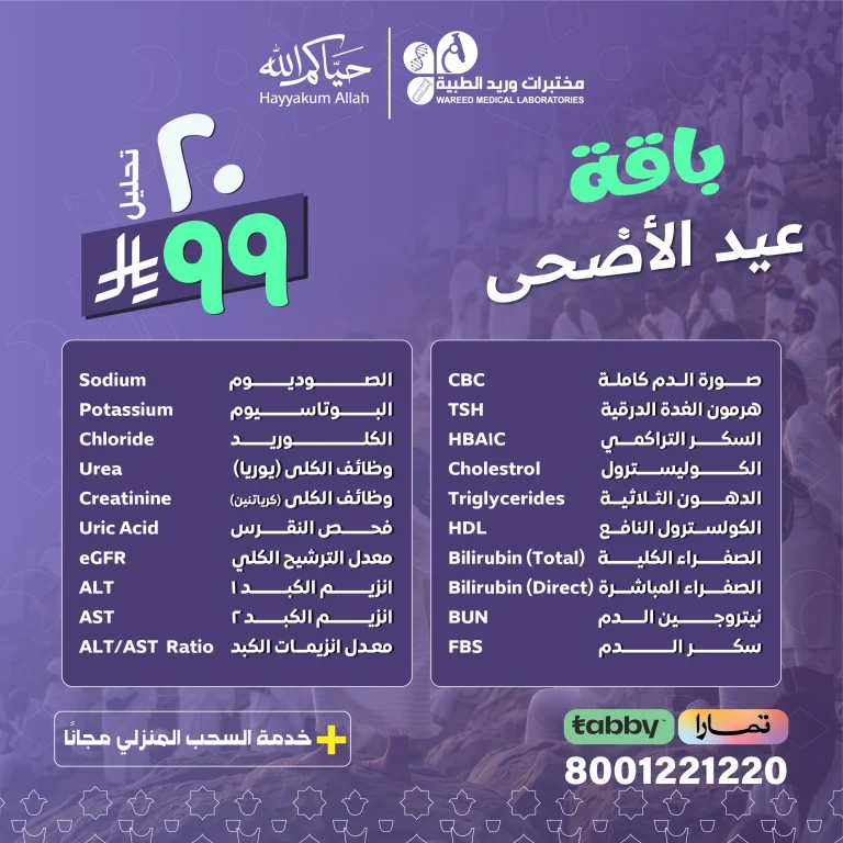 عرض عيد الأضحى