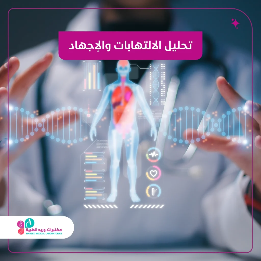 تحليل الالتهابات والإجهاد