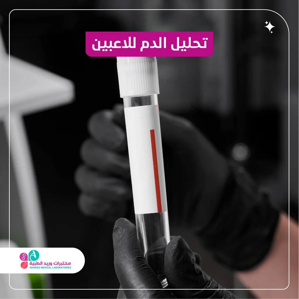 تحليل الدم للاعبين