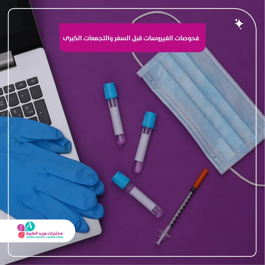 فحوصات الفيروسات قبل السفر والتجمعات الكبرى: خطوة أساسية لحماية صحتك