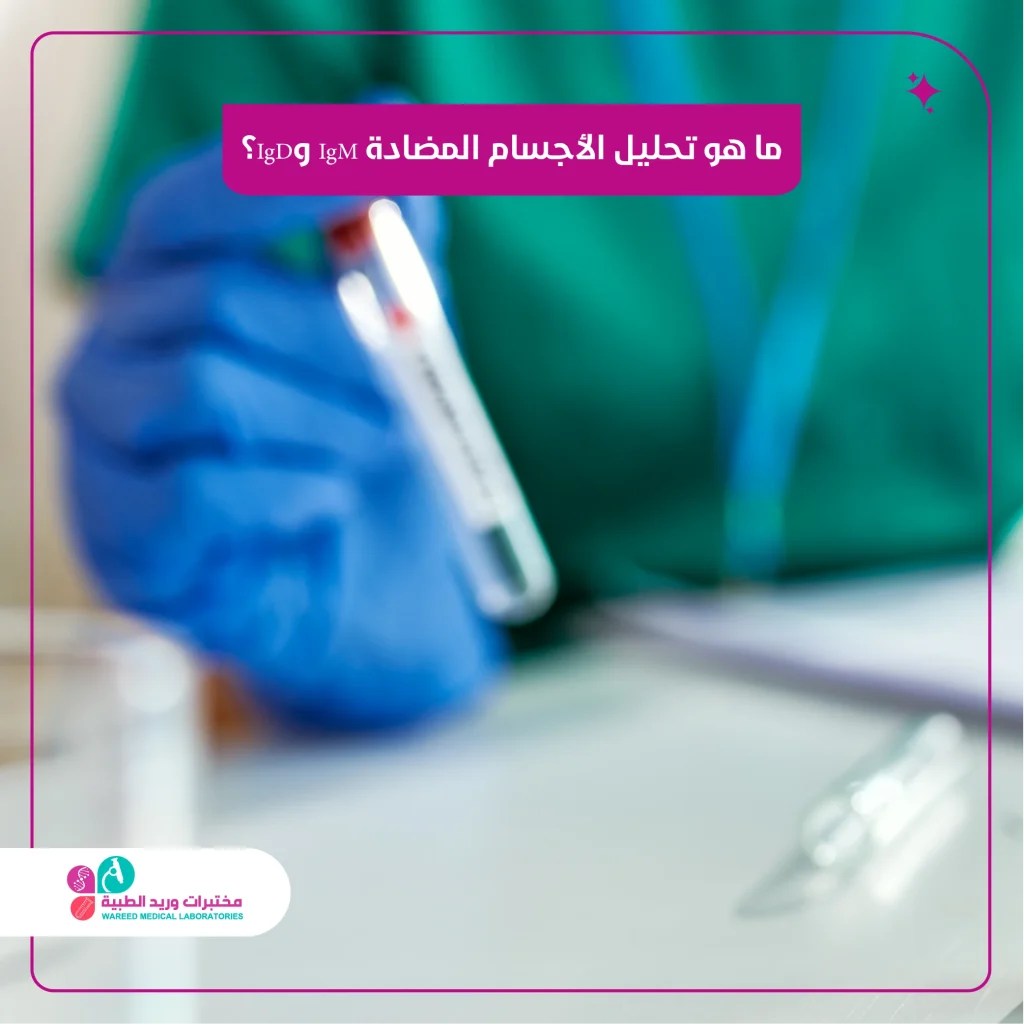 ماهو تحليل الأجسام المضادة