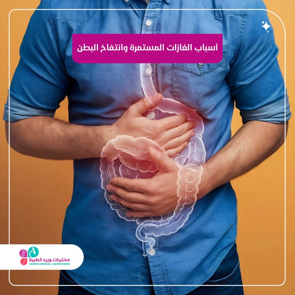 أسباب الغازات المستمرة وانتفاخ البطن: متى يكون الأمر طبيعيًا ومتى يستدعي الانتباه؟