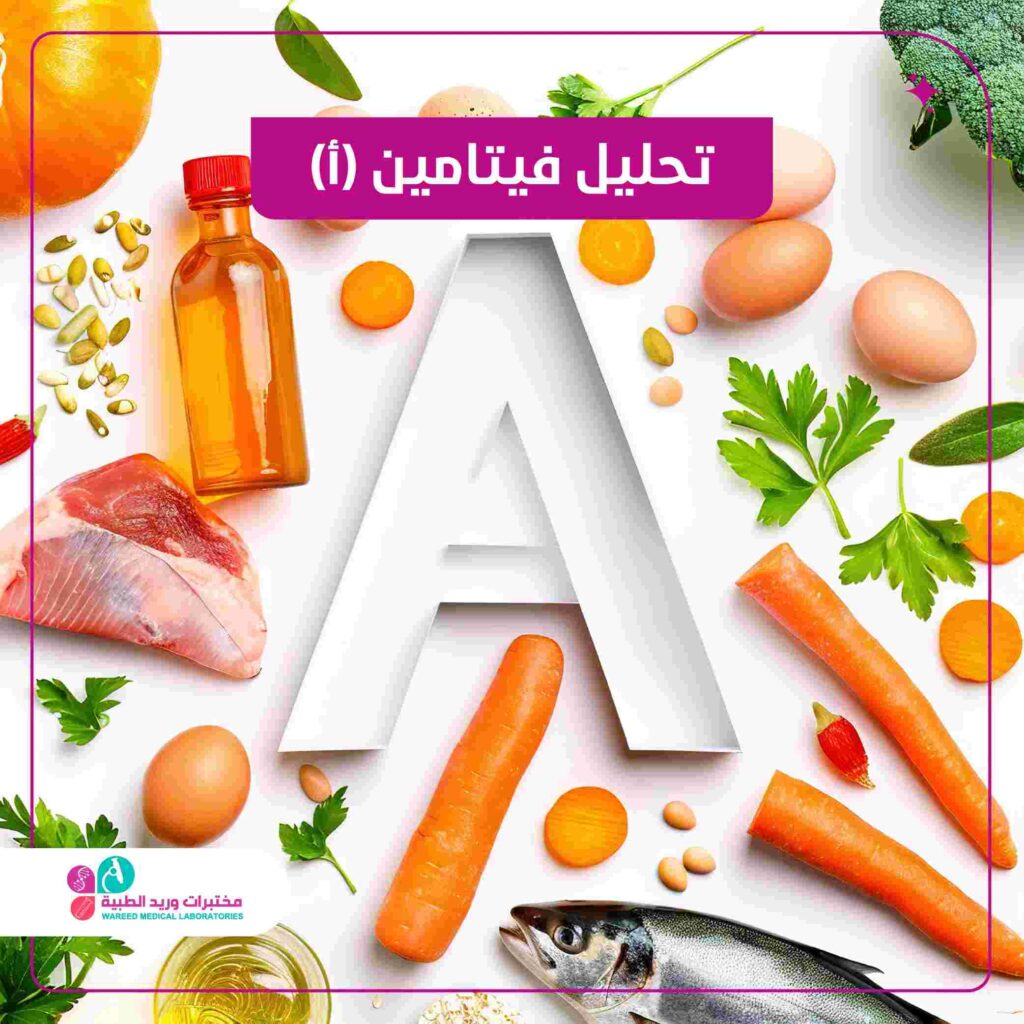 تحليل فيتامين أ
