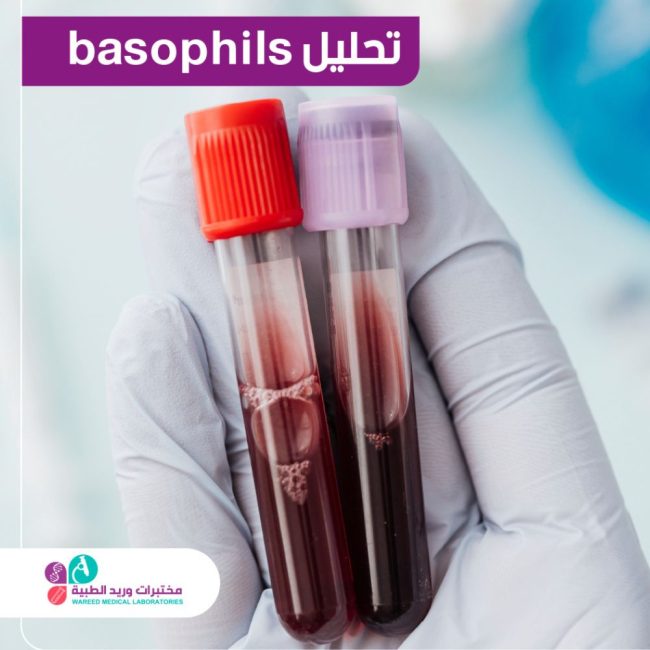 تحليل Basophils