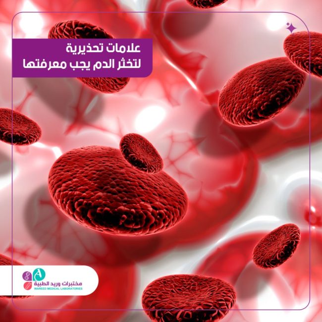 علامات تحذيرية ل تخثر الدم يجب معرفتها